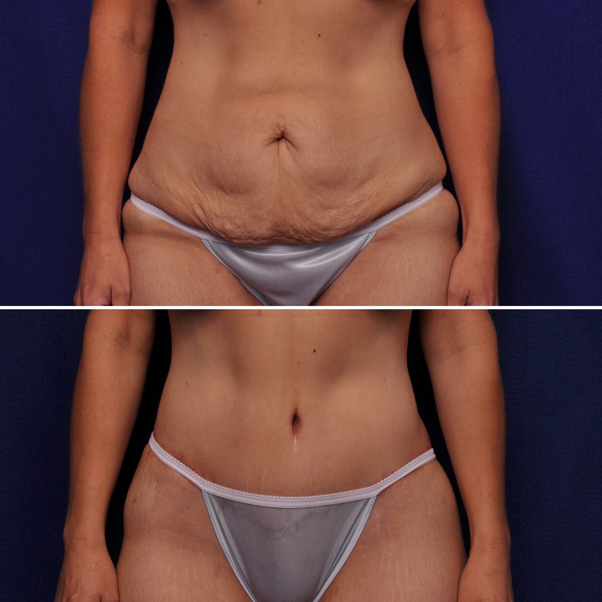 Vero Beach, FL plastic surgeon Alan Durkin, MD