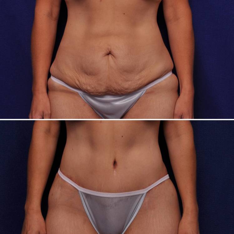 Vero Beach, FL plastic surgeon Alan Durkin, MD