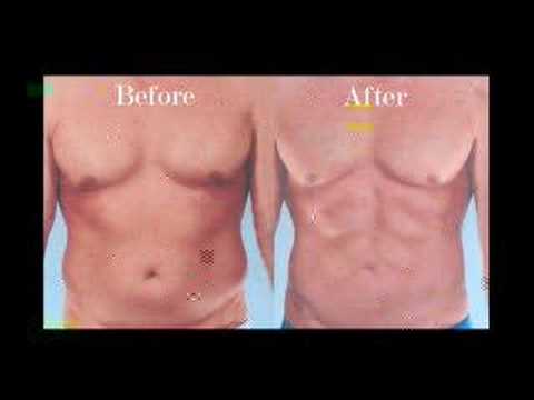 Dr. Mentz Ab Etching