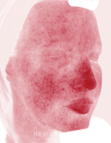 Dr. Kenneth Beer - Brightening Serum - Before