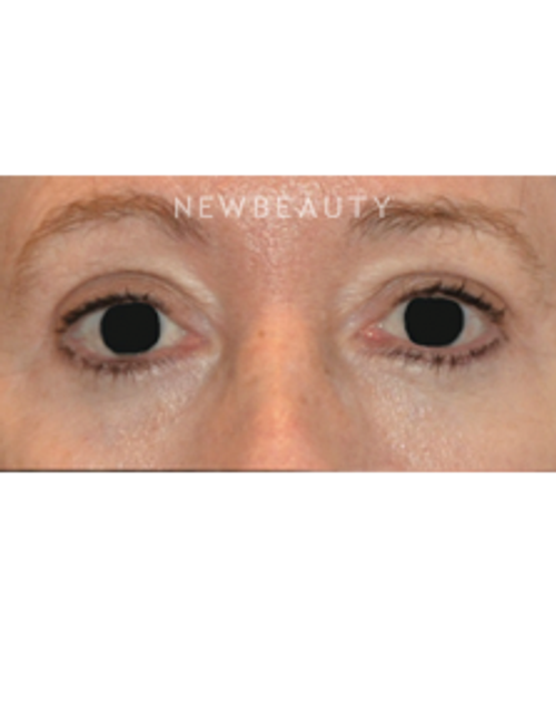Dr. B. Aviva Preminger - A Fresh Look - After