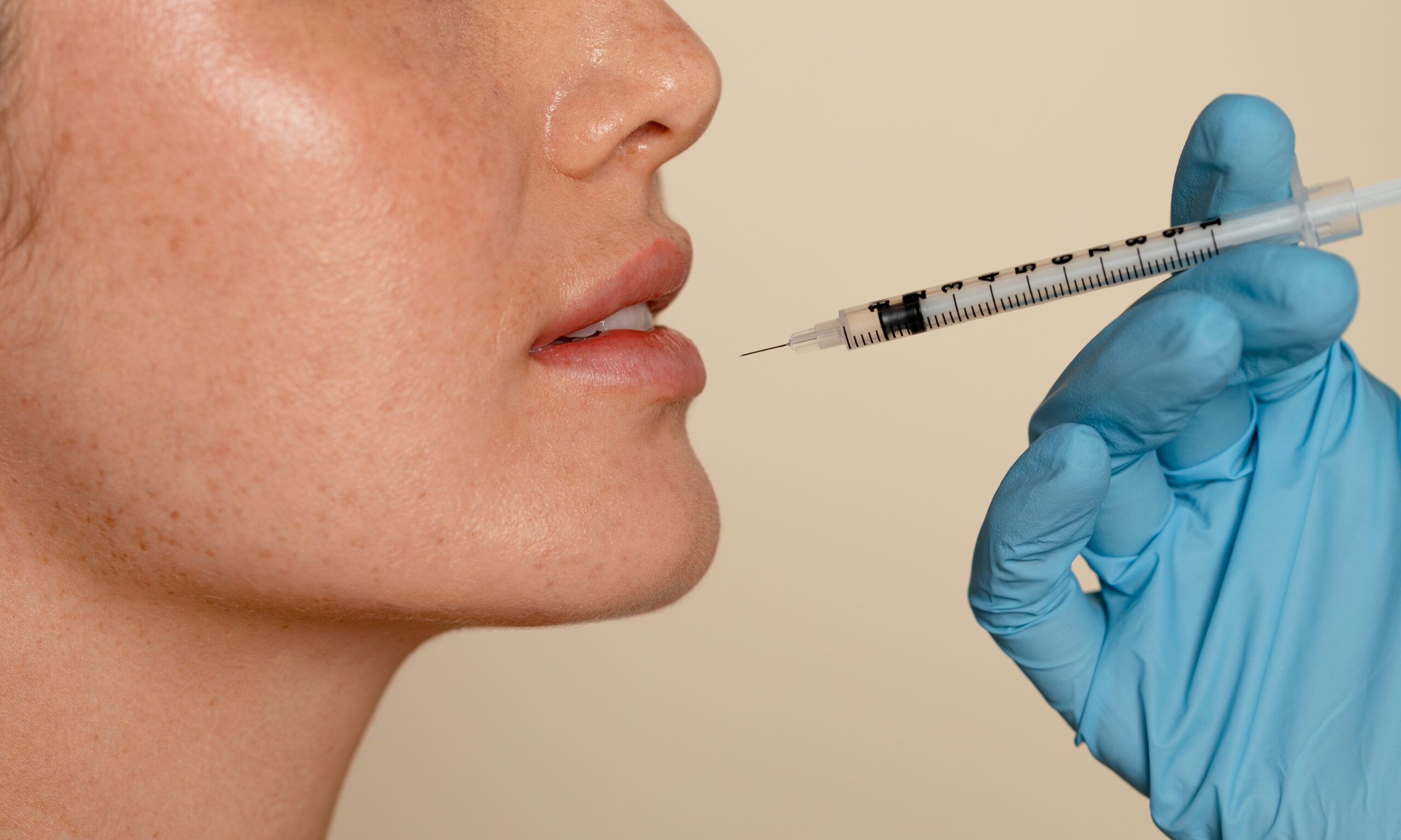 Close view of lip filler, injectable beauty treatment