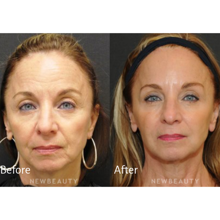 Younger-Looking Skin
