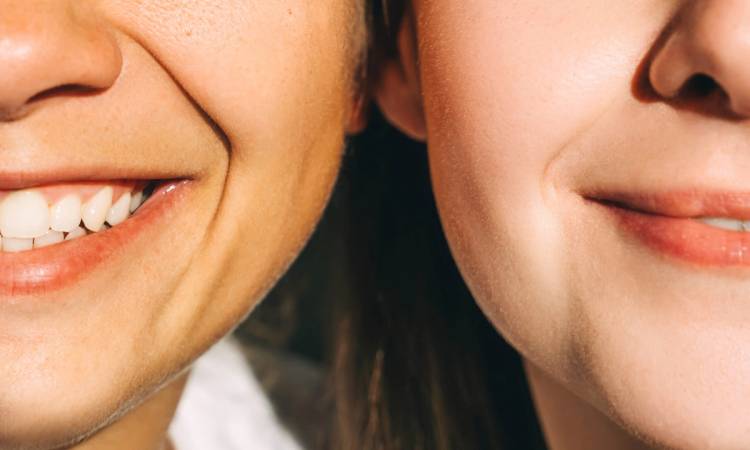 dermelect upper lip lines treatment