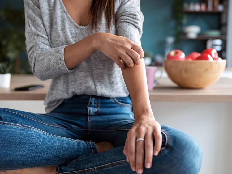 A New FDA-Approved Eczema Cream Is Also Being Used to Treat Vitiligo