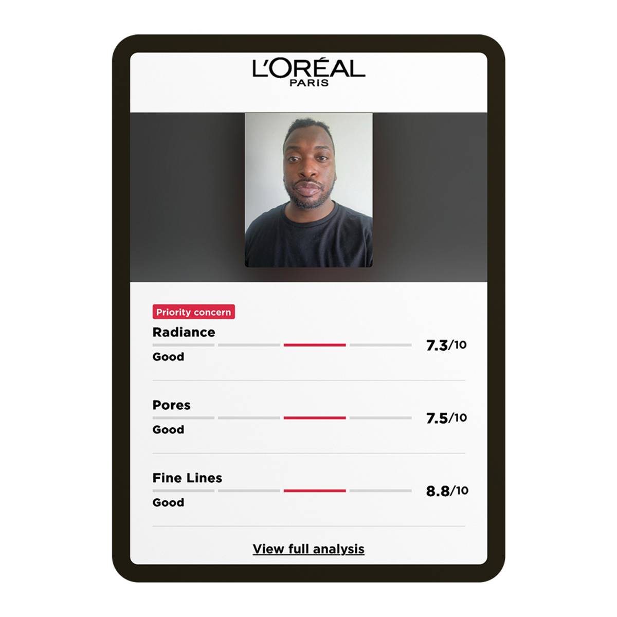 L’Oréal SkinGenius