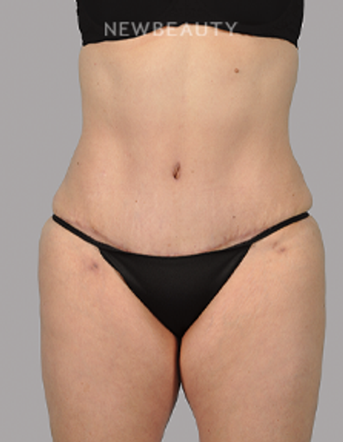 Dr. David Alfonso - A New, Improved Contour - 20903552 - After