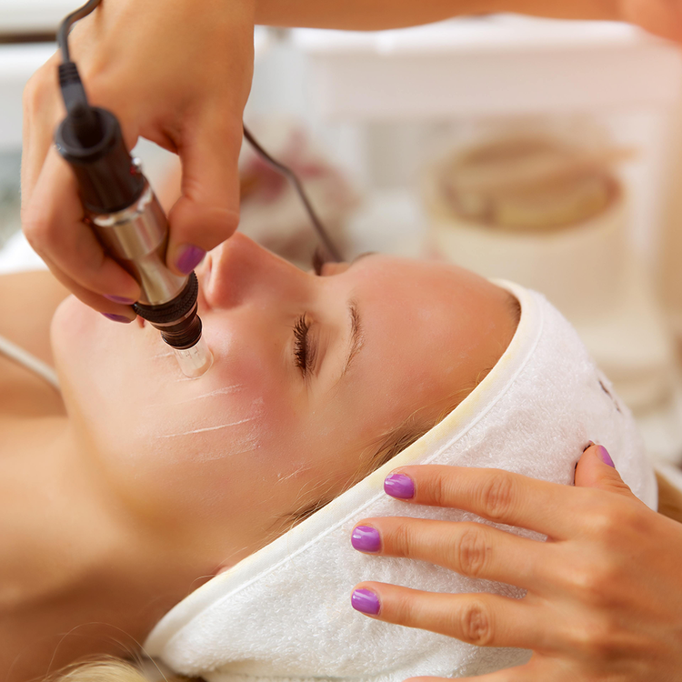 microneedling