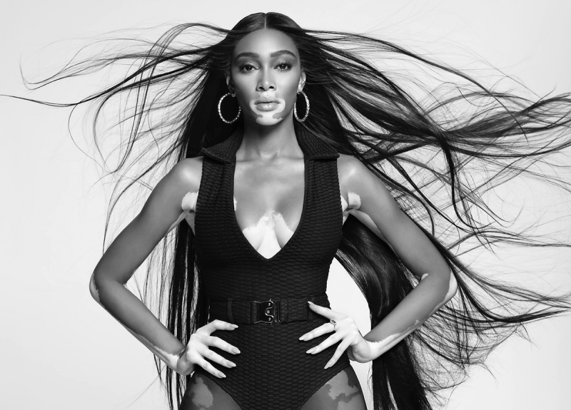 Winnie Harlow Is Paul Mitchell’s First-Ever Global Ambassador