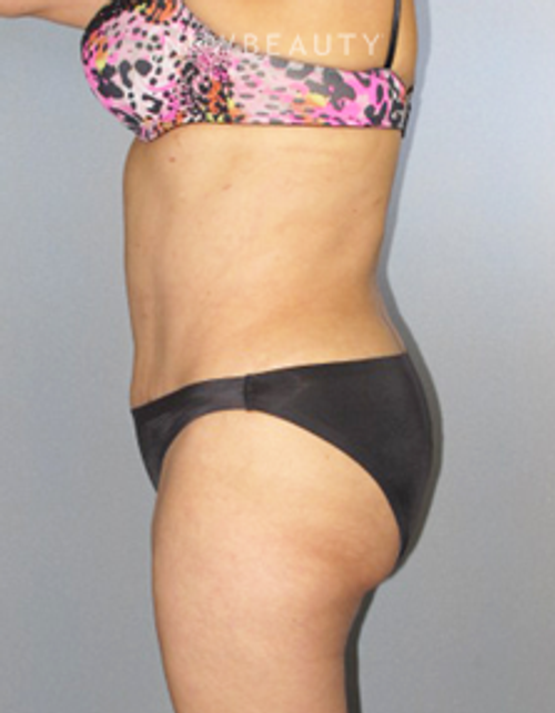 Dr. German Newall - Shapely Restoration - After