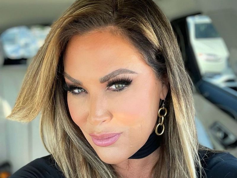 Real Housewife Emily Simpson Opens up About Her Recent Facelift