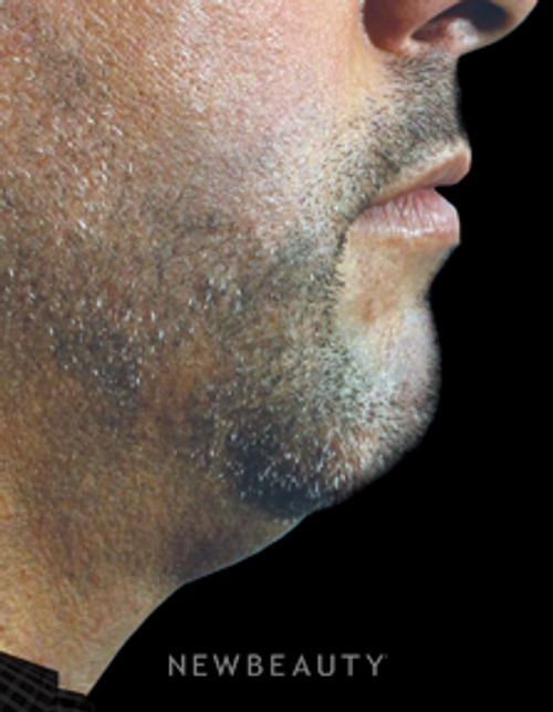 Dr. Marina Peredo - Improved Profile - After