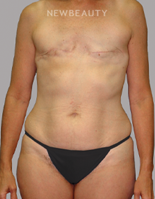 Dr. Mahabir - Feeling Whole Again - Before