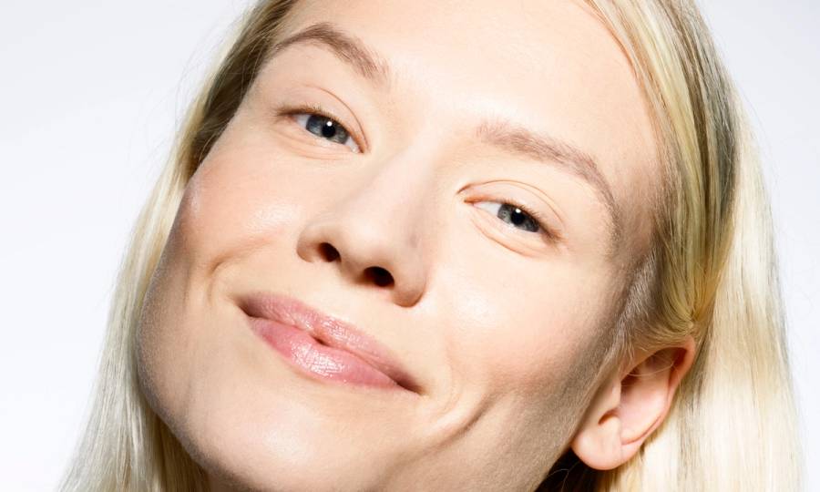 acne laser results