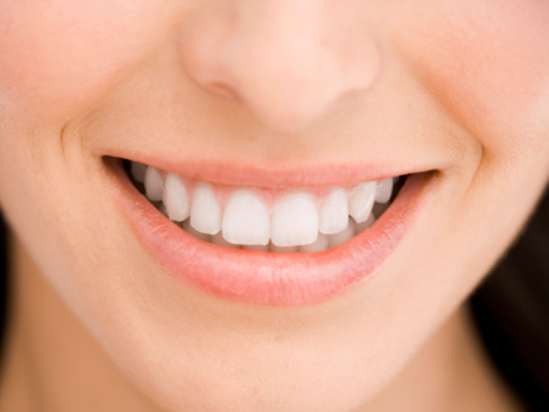 smile Main Newbeauty