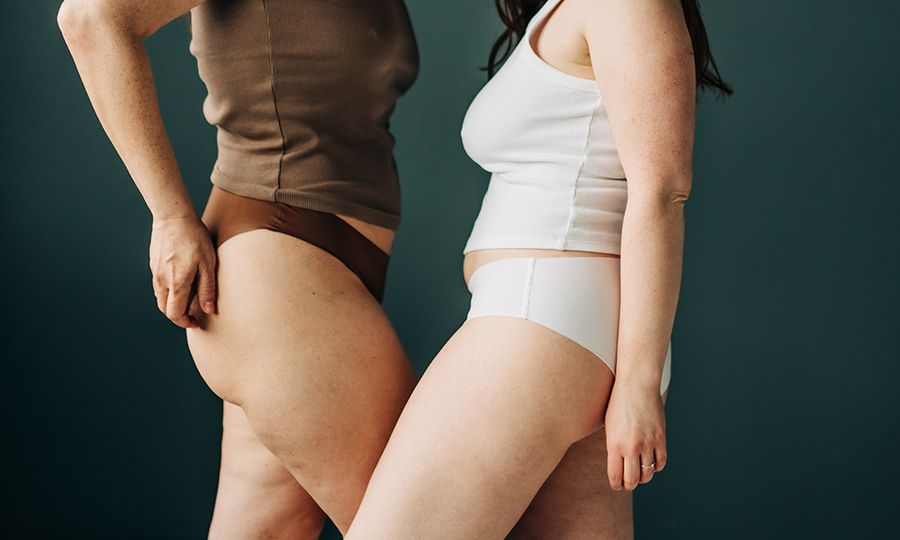 Why Does No One Want to Talk About Cellulite?