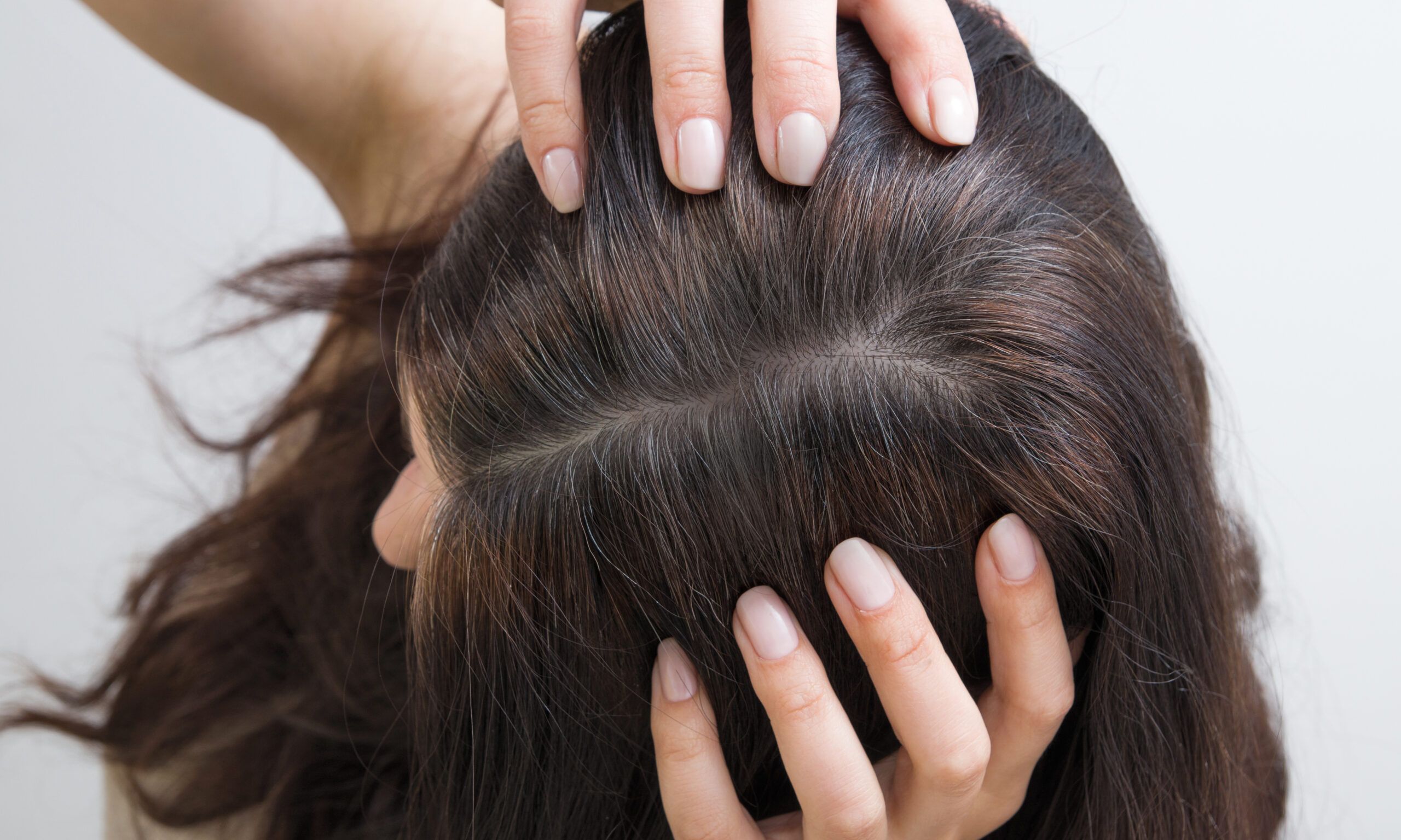 top view of woman's hair and scalp