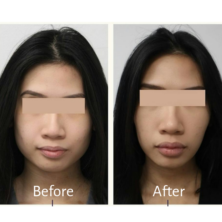Youthful Slimming