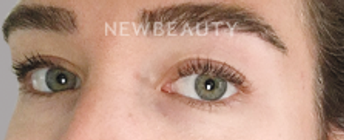 Dr. Jeffrey Epstein - Defined Brows - 44714704 - After