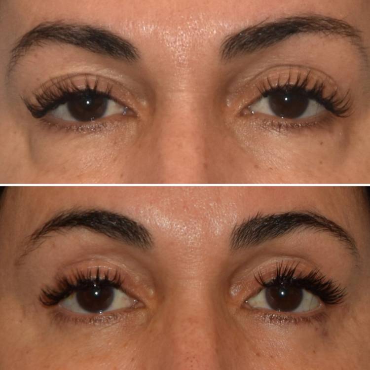New York plastic surgeon Andrew Peredo, MD