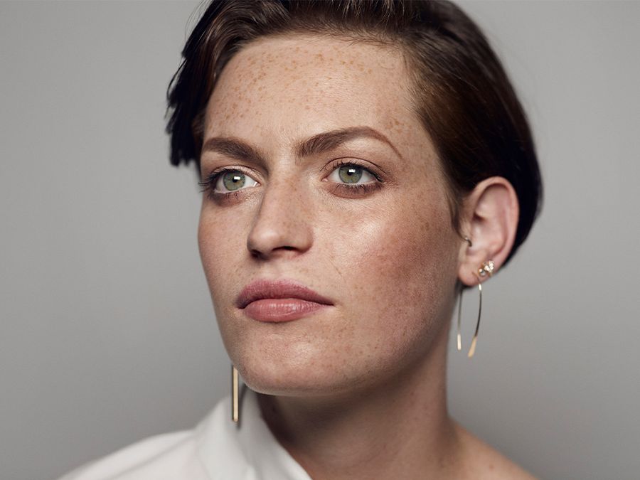 A DIY Freckle Hack Gone Wrong Left This Woman With Scars and Temporary Blindness