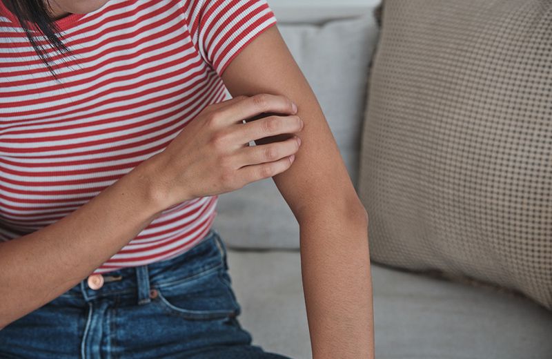 There Is Now an Official Seal for Rosacea-Safe Cosmetic Products