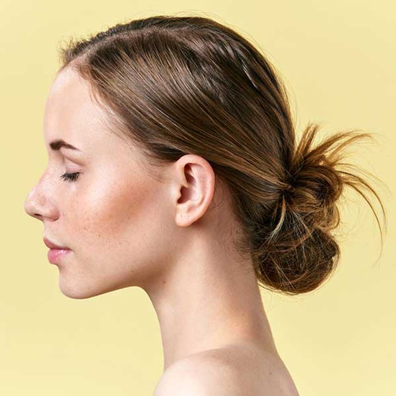 Allergan Juvederm Voluma