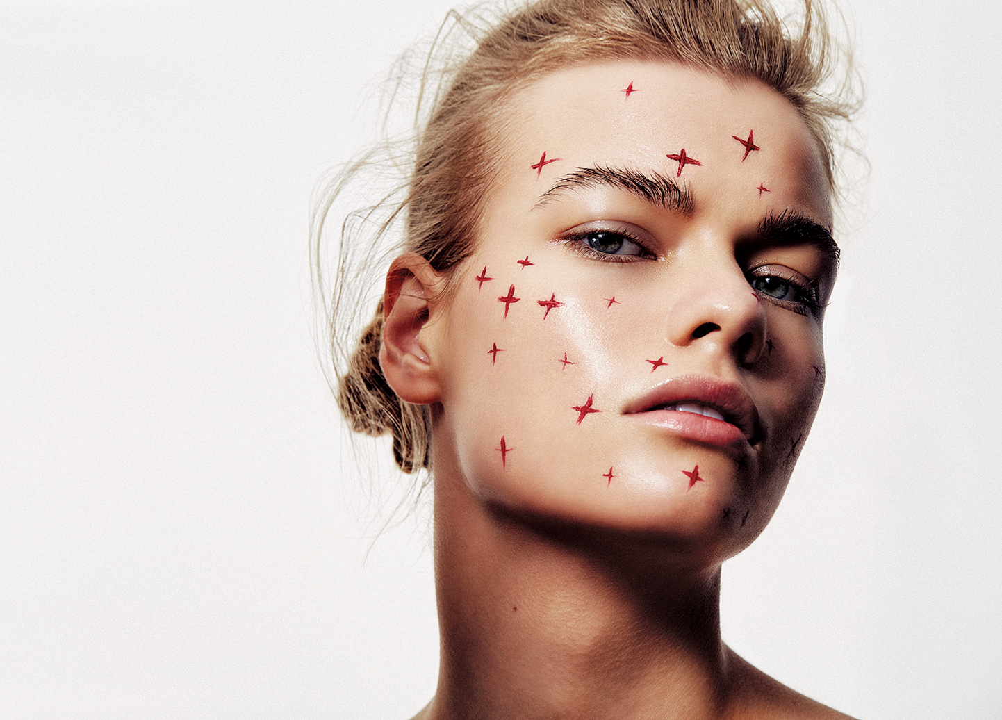 Clear Future: Is Adult Acne a New Problem?