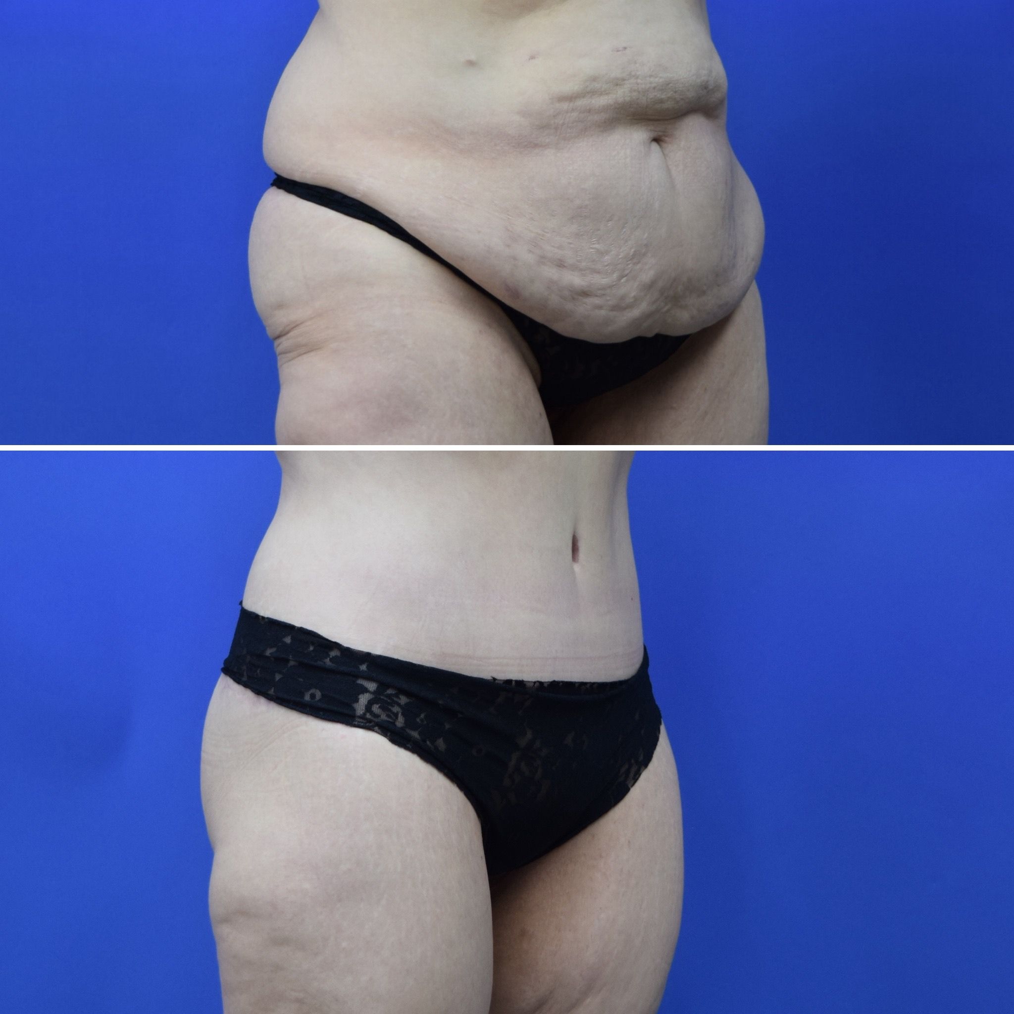 Houston, TX plastic surgeon Olga Bachilo, MD