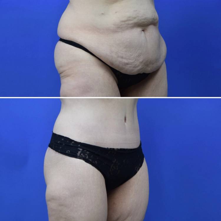 Houston, TX plastic surgeon Olga Bachilo, MD