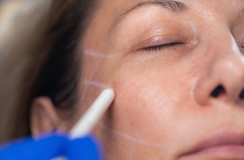 Why Some Plastic Surgeons Say the ‘Control Factor’ Is Fueling a Rise in Aesthetic Treatments During COVID