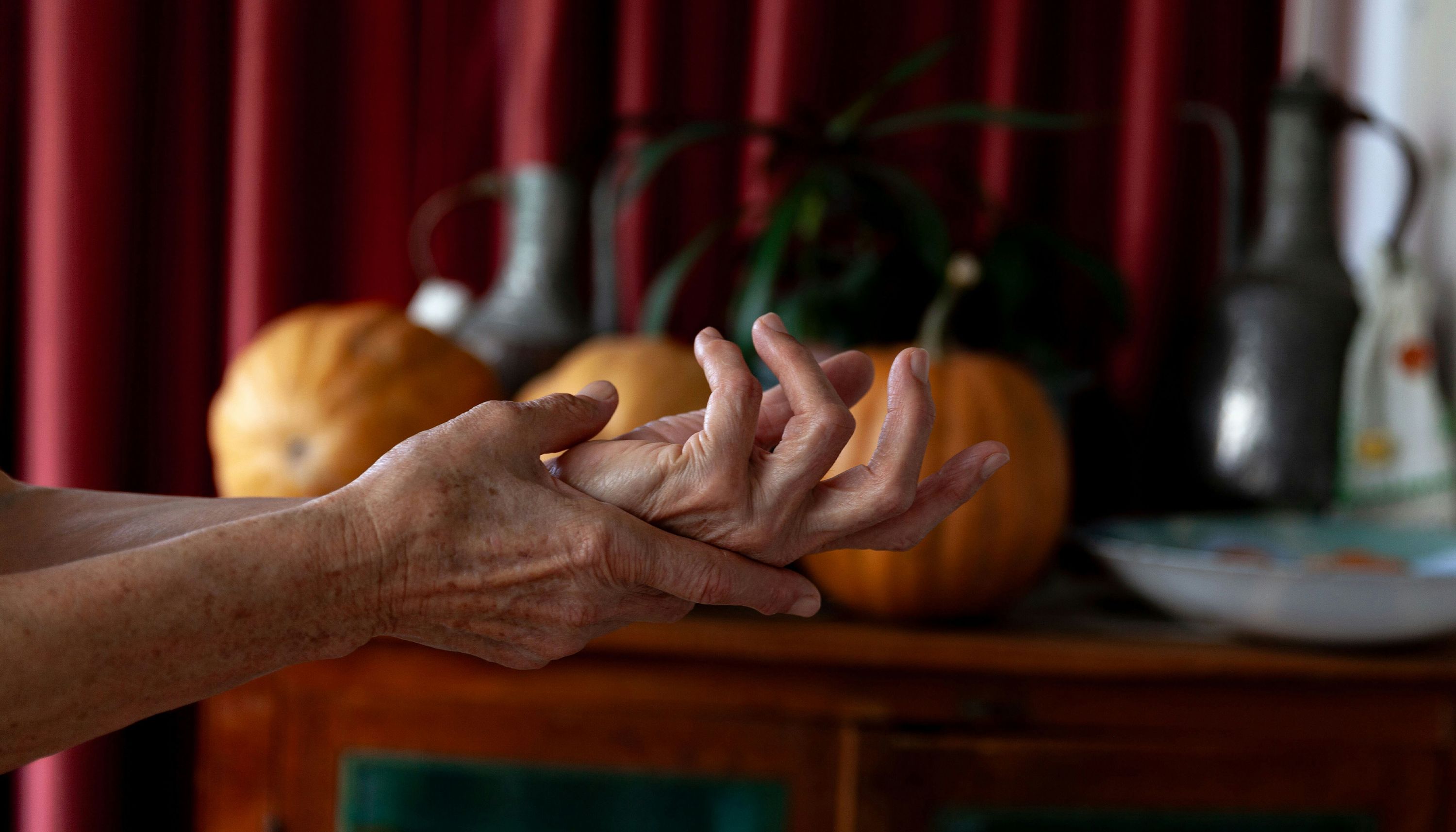 hands with fine lines and wrinkles