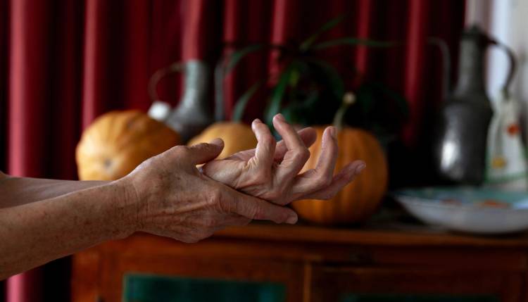 hands with fine lines and wrinkles