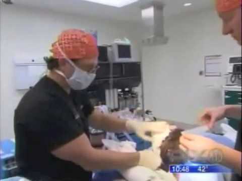 Dr. Jacono- Plastic Surgery For Domestic Violence Survivor