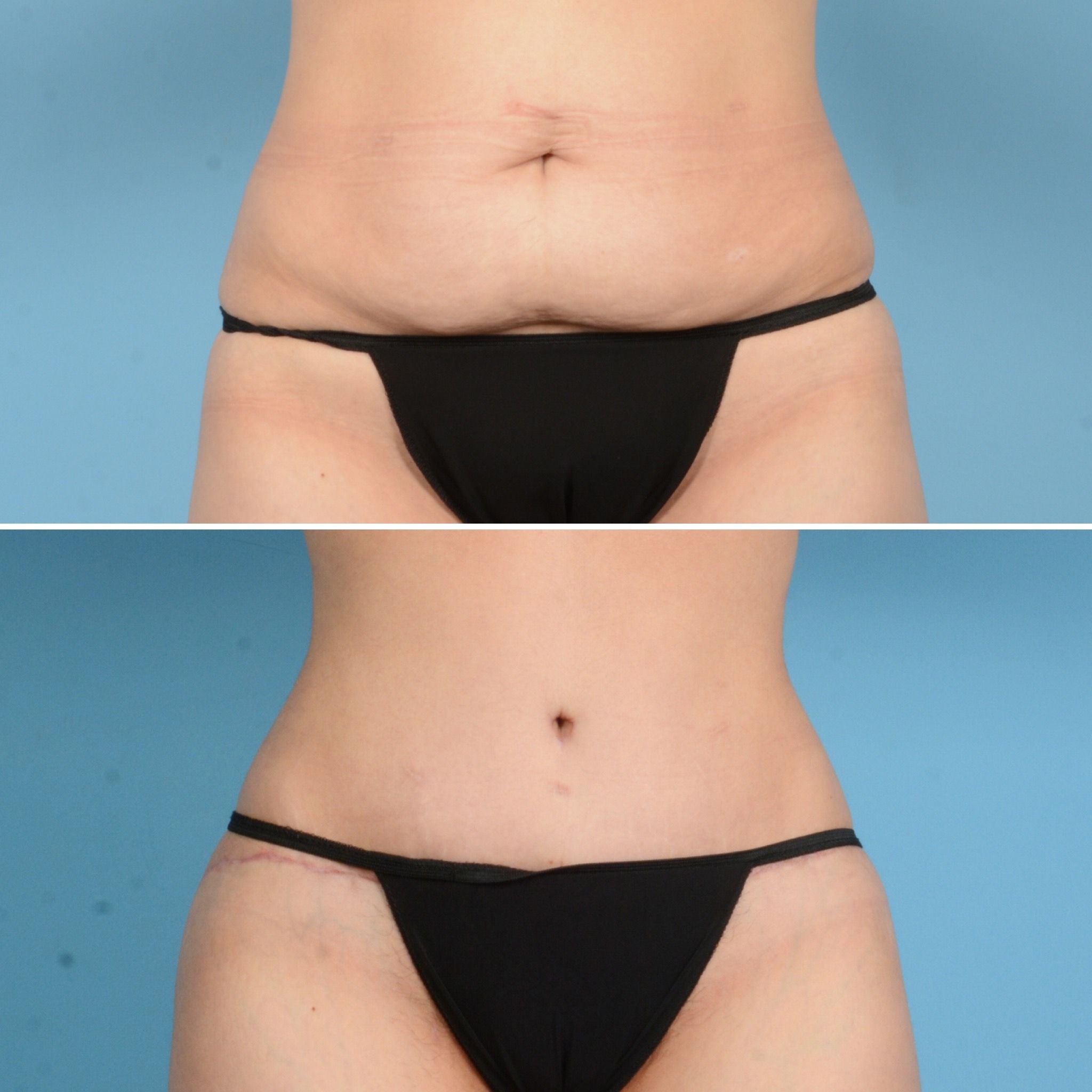 Houston, TX plastic surgeon German Newall, MD