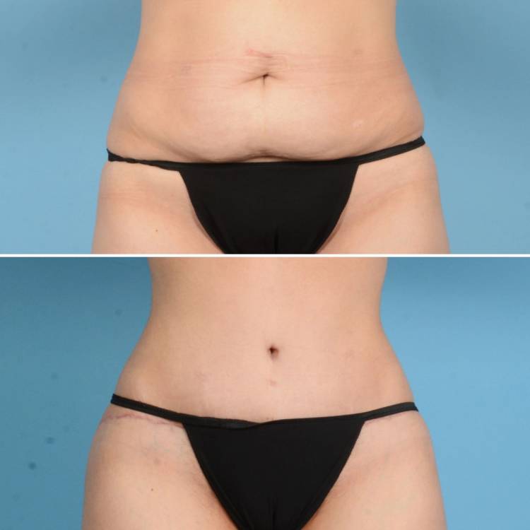 Houston, TX plastic surgeon German Newall, MD