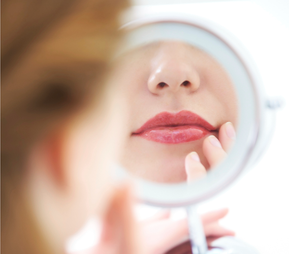 Get Rid of Vertical Lines Around the Mouth: Do it with Fractional CO2 Laser Resurfacing or Hyaluronic Acid Fillers