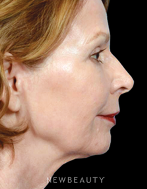 Dr. Bryan W. Gawley - Refreshed and Rejuvenated - After