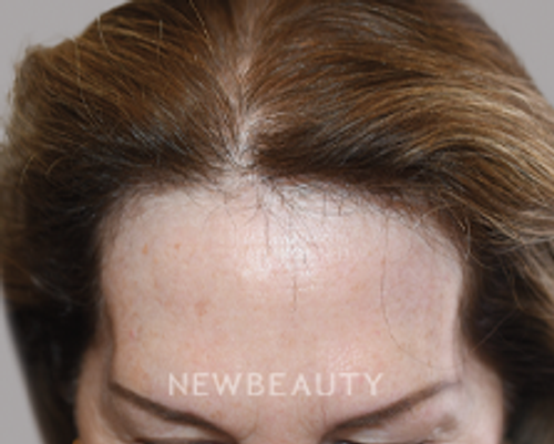 Dr. Jeffrey Epstein - Revived Tresses - 44714605 - After