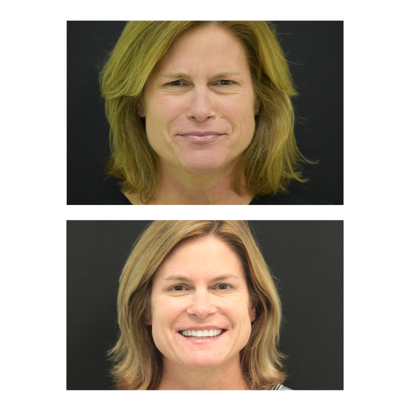 This Top Doctor Takes a Patient-First Approach to Fillers and Injectables