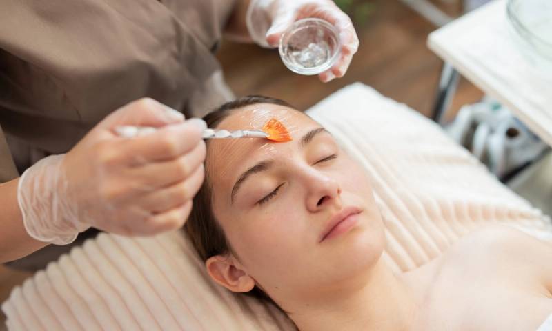 phenol peel