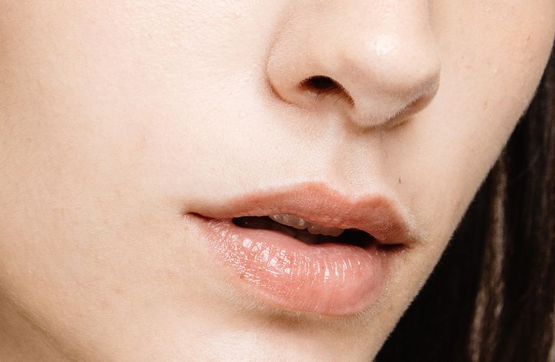 Here’s What You Need to Know About Lip-Lightening Treatments