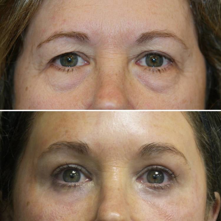Duxbury, MA plastic surgeon Christine Hamori, MD