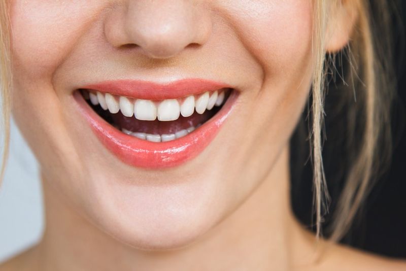 shutterstock 533654098 1