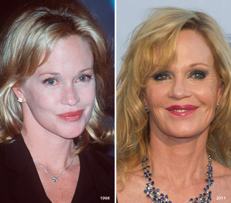 Melanie Griffith