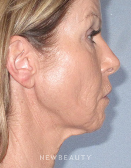 Dr. German Newall - Refreshed Look - Before