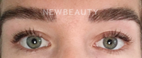 Dr. Jeffrey Epstein - Defined Brows - 44714704 - After