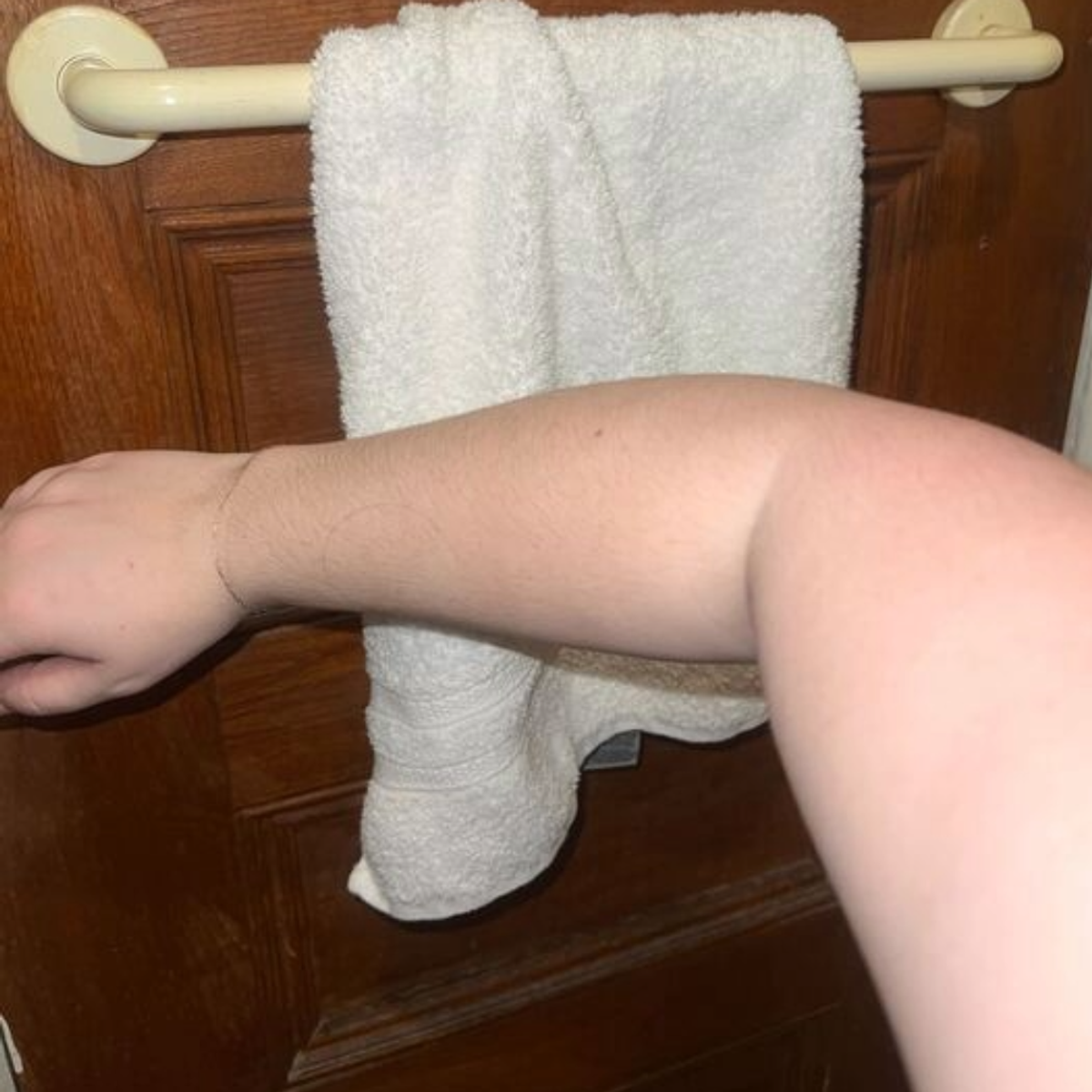 before saltyface on arm