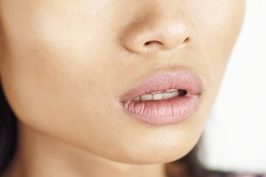 lipthreadlift