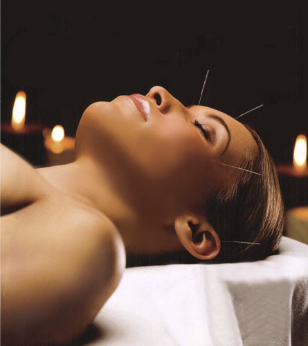 Acupuncture